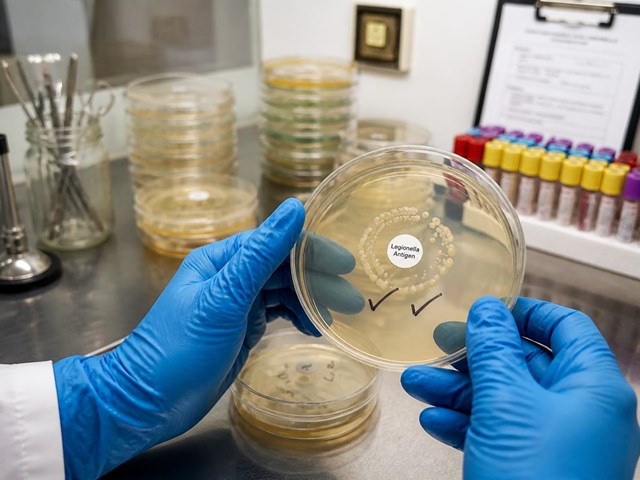 Diseña tu plan de prevención de legionella en Santiago y protege tu instalación